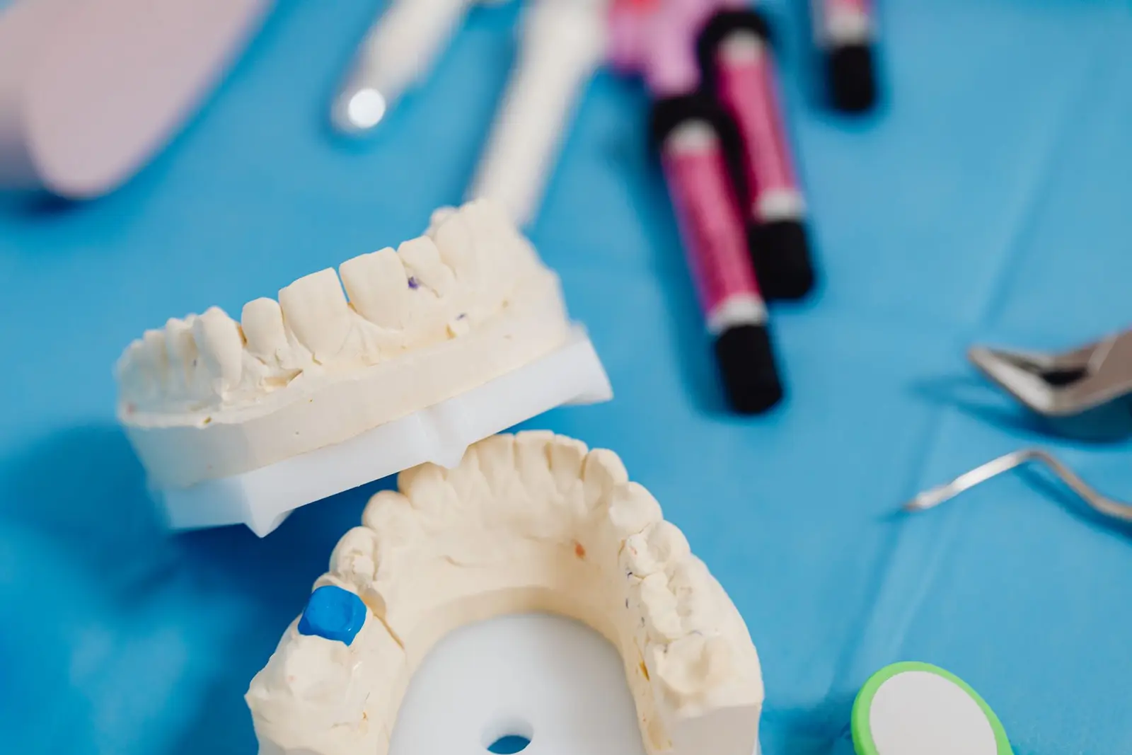 Dental Crowns at AM Denturologiste dental clinic in Sainte-Julie