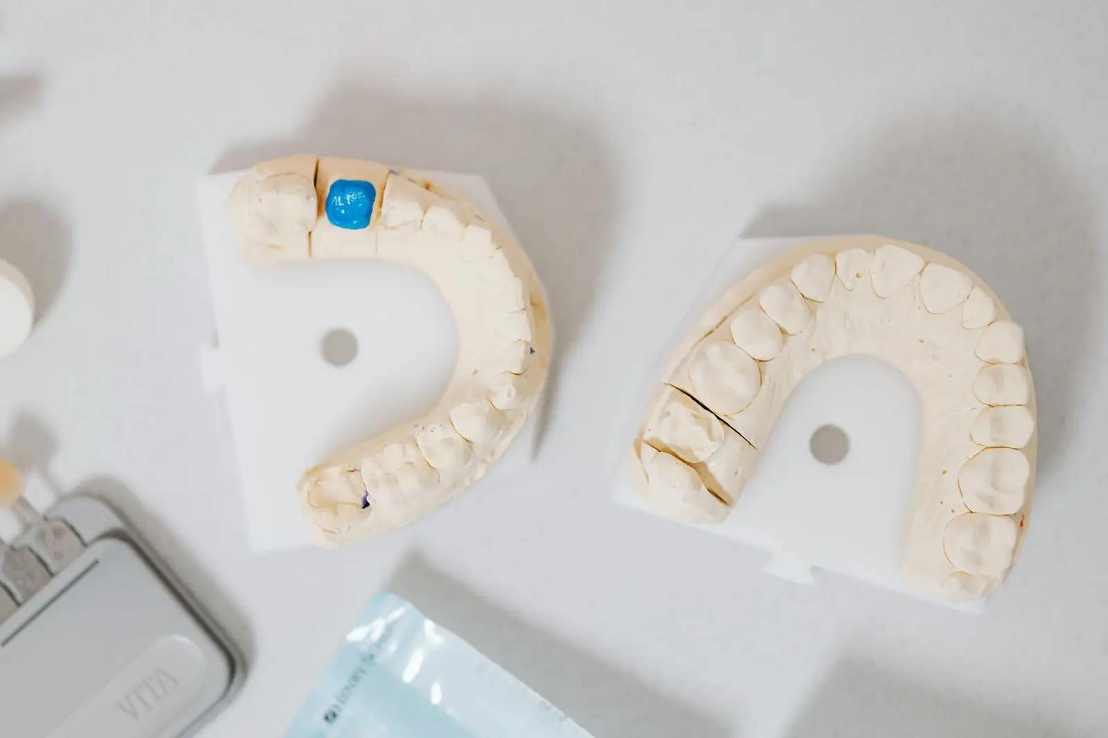 Dental Crowns and Bridges at AM Denturologiste dental clinic in Sainte-Julie