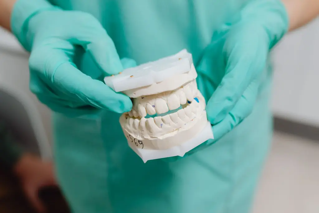 Fixed Bridges — dental care in Sainte-Julie