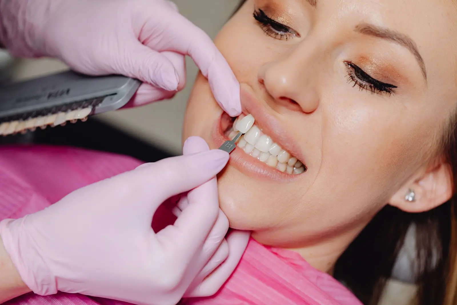 Cosmetic Dentistry at AM Denturologiste dental clinic in Sainte-Julie