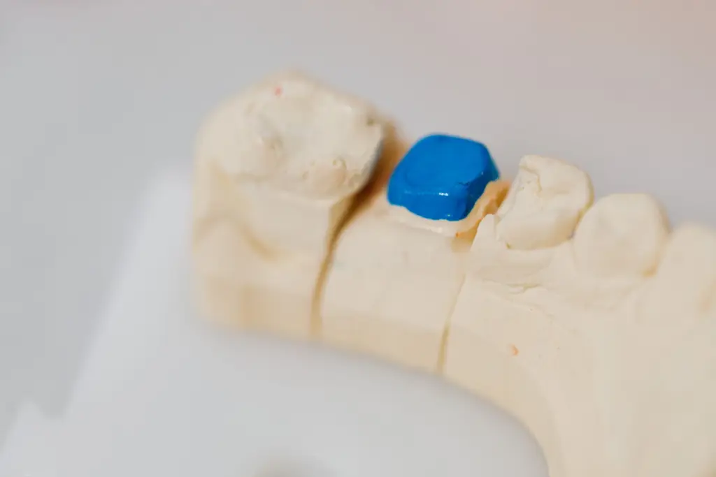 Dental Fillings — dental care in Sainte-Julie