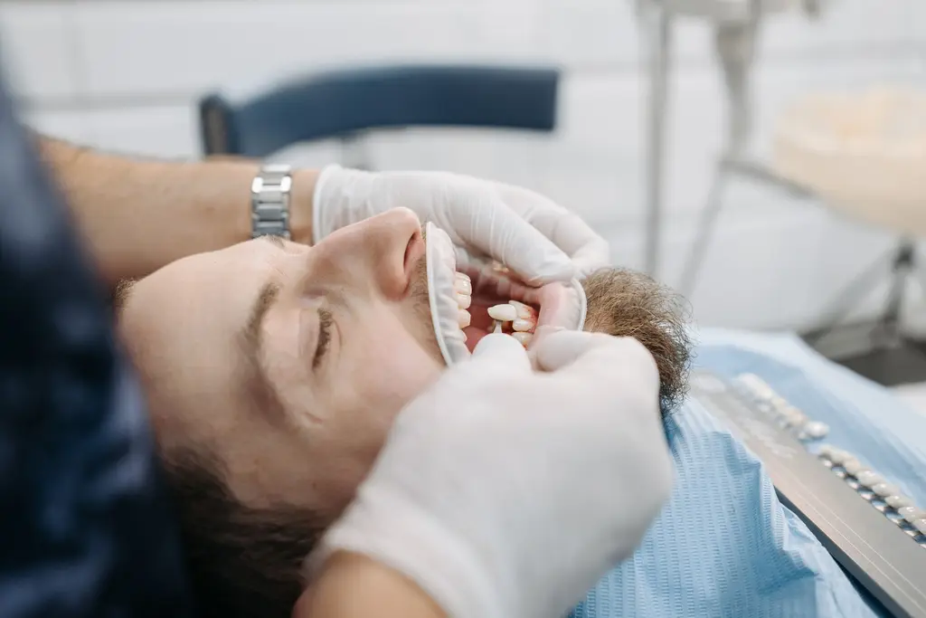 Dental Sealants — dental care in Sainte-Julie