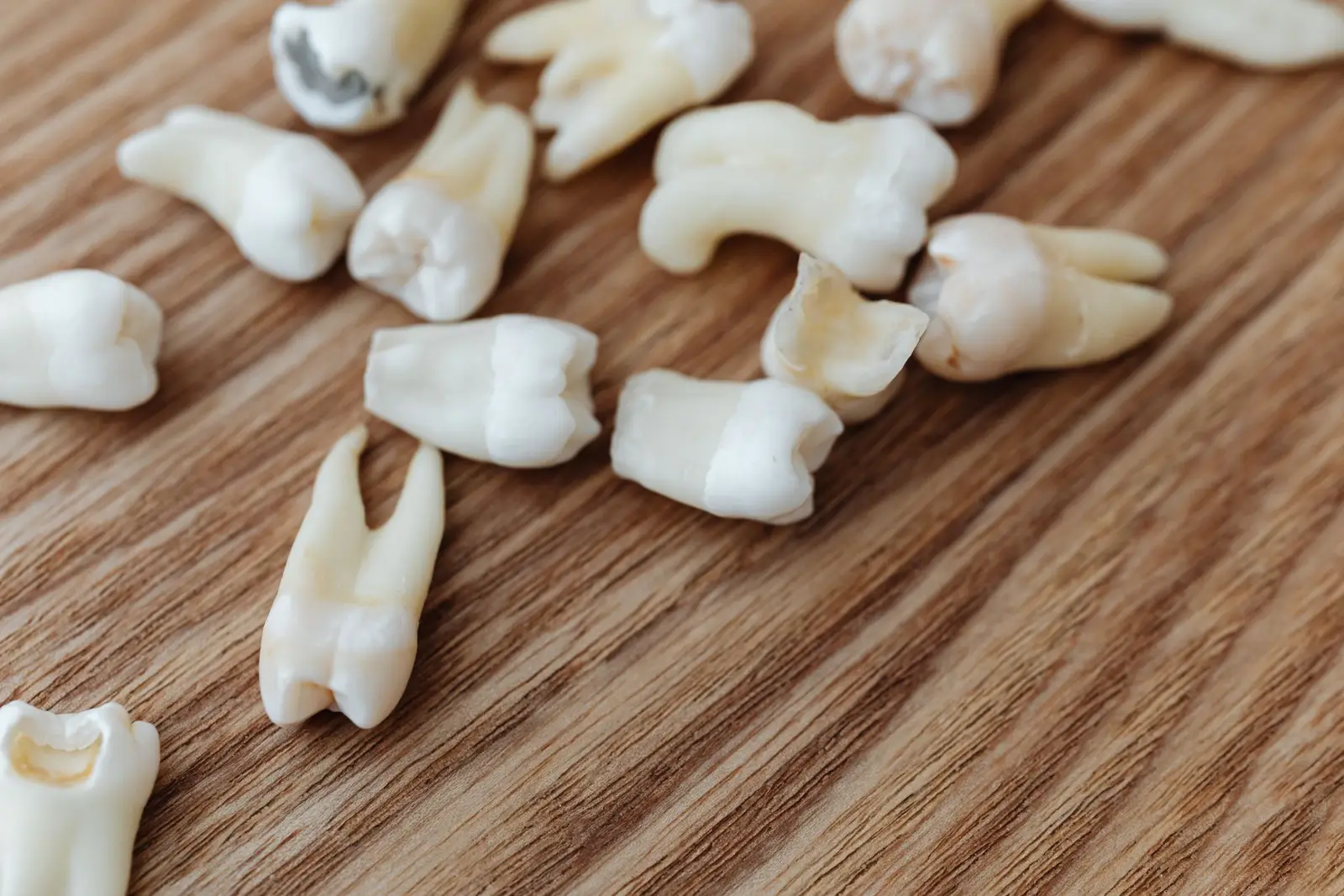 Dental Sealants at AM Denturologiste dental clinic in Sainte-Julie