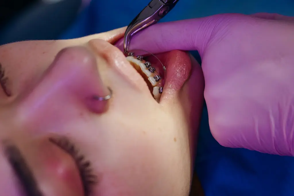 Orthodontics — dental care in Sainte-Julie