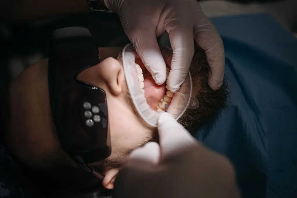Gum Graft — dental care in Sainte-Julie