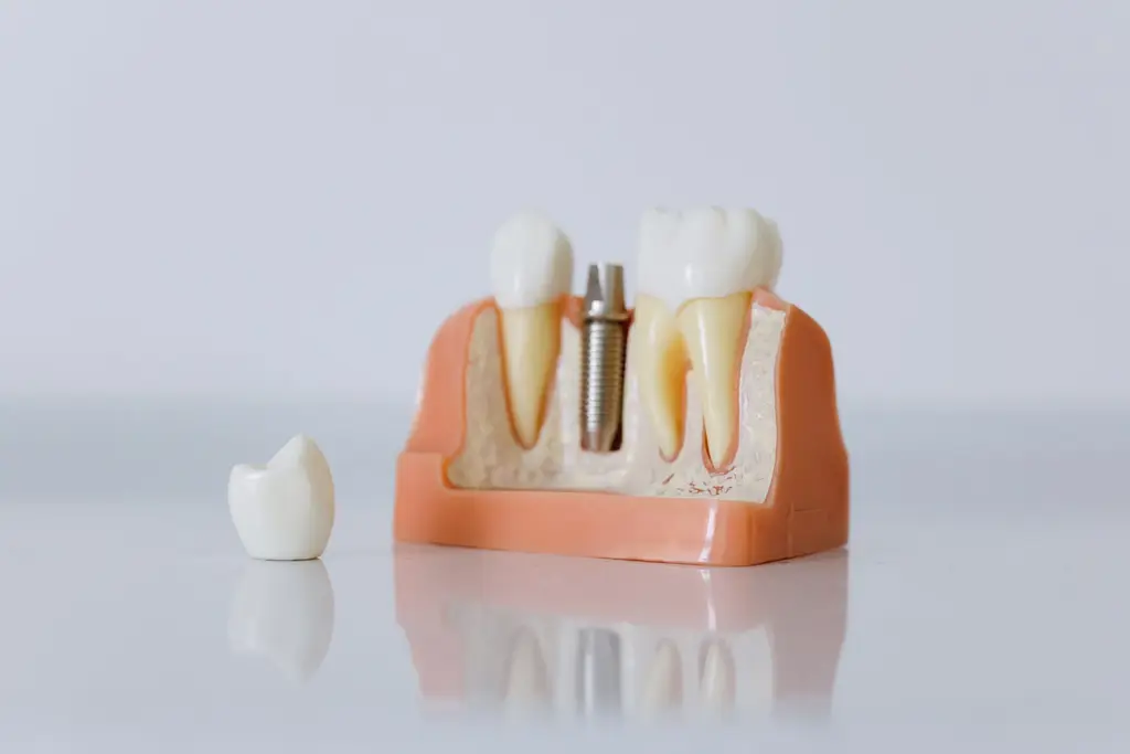 Dentures — dental care in Sainte-Julie
