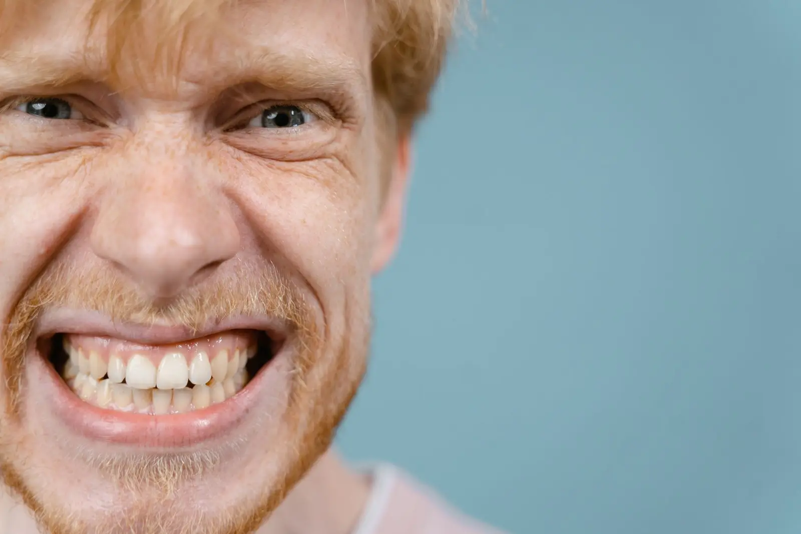 Dental Bruxism Treatment at AM Denturologiste dental clinic in Sainte-Julie