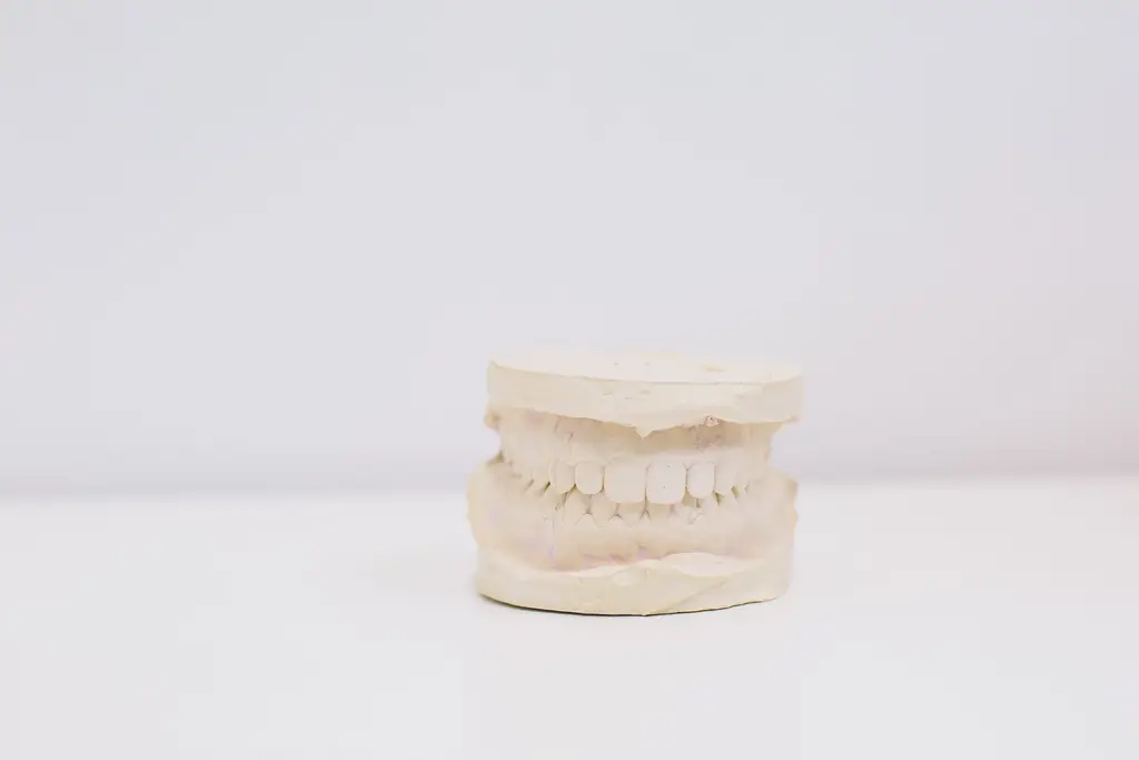 Dental Occlusal Splint — dental care in Sainte-Julie
