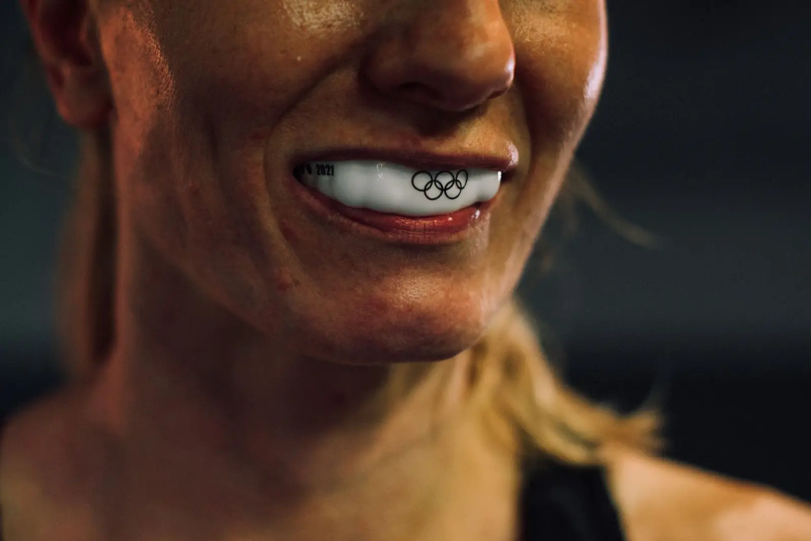 Custom Mouthguards at AM Denturologiste dental clinic in Sainte-Julie